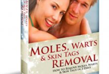 Moles Warts Skin Tags Removal™ How To Remove Your Moles, Warts And Skin Tags Easily and Permanently? - 22
