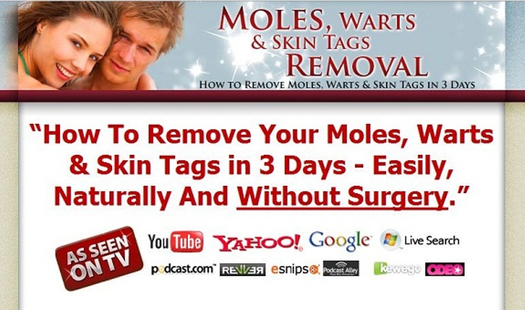 moles-warts-skin-tags-removal-head How To Remove Your Moles, Warts And Skin Tags Easily and Permanently?