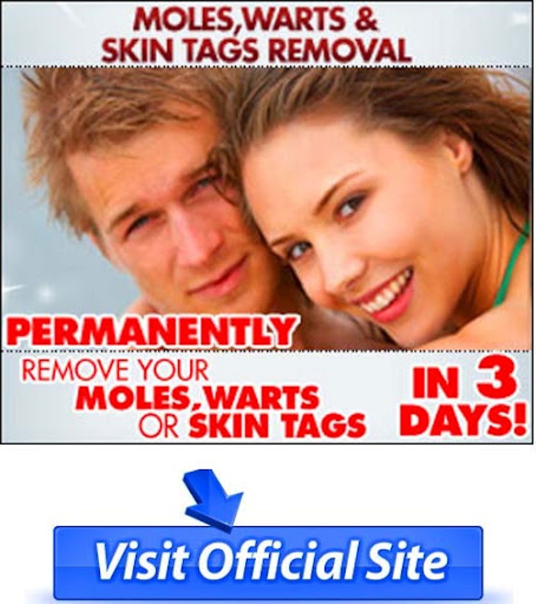 moles-warts-skin-tags-removal-review How To Remove Your Moles, Warts And Skin Tags Easily and Permanently?