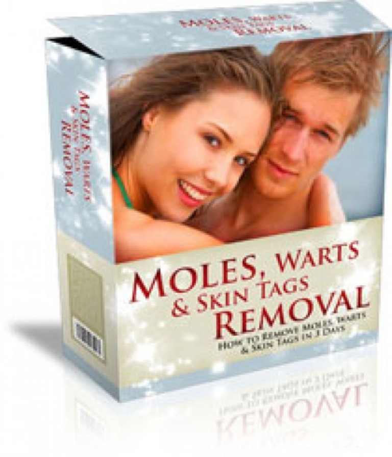 moles-warts-skin-tags-removal How To Remove Your Moles, Warts And Skin Tags Easily and Permanently?