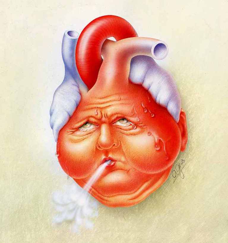 What Are the Risks of Sleeping Less Than 6 Hours a Night? 12 ChronicHeartFailure