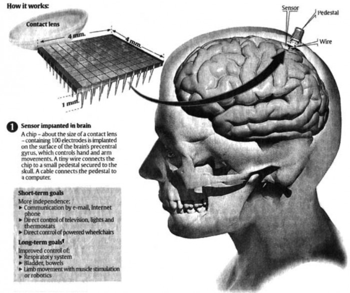 microchip-implant-on-the-brain Top 10 Biggest Weird Government Secrets that You Do Not Know