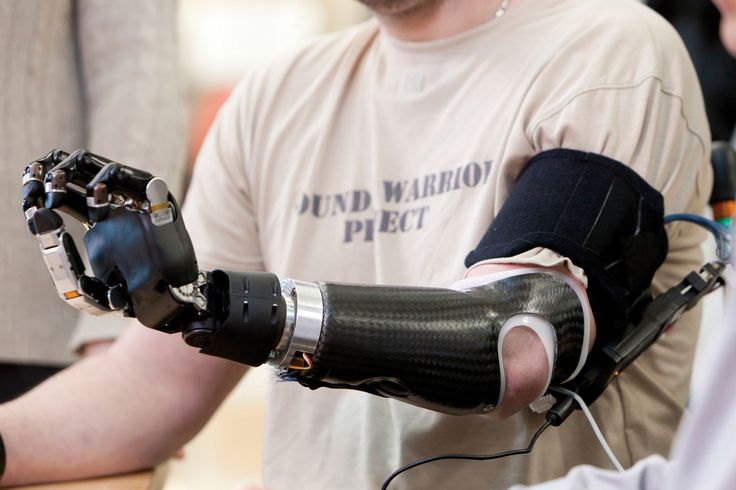 The Top Trends in the Future of Healthcare 9 Powerful Prosthetics