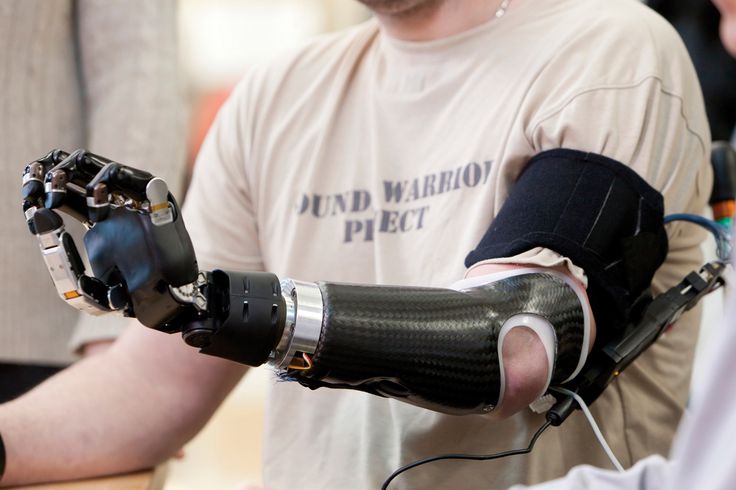 Powerful-Prosthetics The Top Trends in the Future of Healthcare