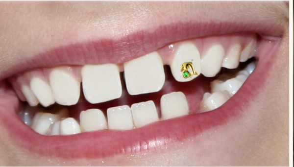 45 Amazing Teeth Jewelry Pieces For Extra Beauty 29 Lilly_dolphin