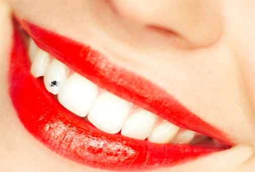 bijuterie-dentara 45 Amazing Teeth Jewelry Pieces For Extra Beauty