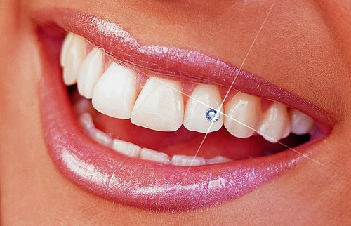 diamand-zuby_int 45 Amazing Teeth Jewelry Pieces For Extra Beauty
