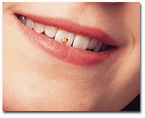 smile-1 45 Amazing Teeth Jewelry Pieces For Extra Beauty