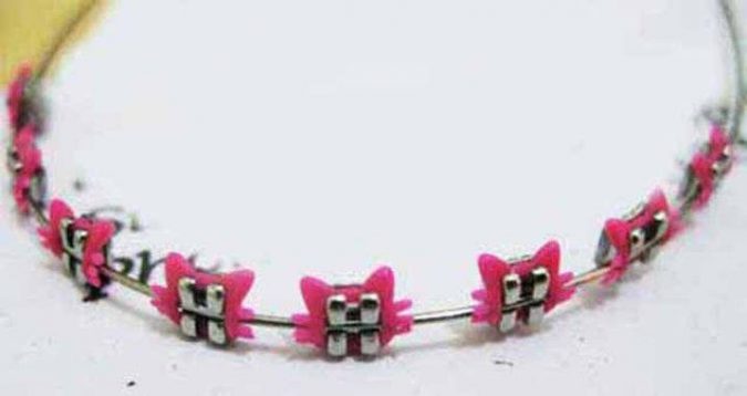 9 Unusual «Hello Kitty» Products! 15 Braces Design 9 Unusual «Hello Kitty» Products! - 15