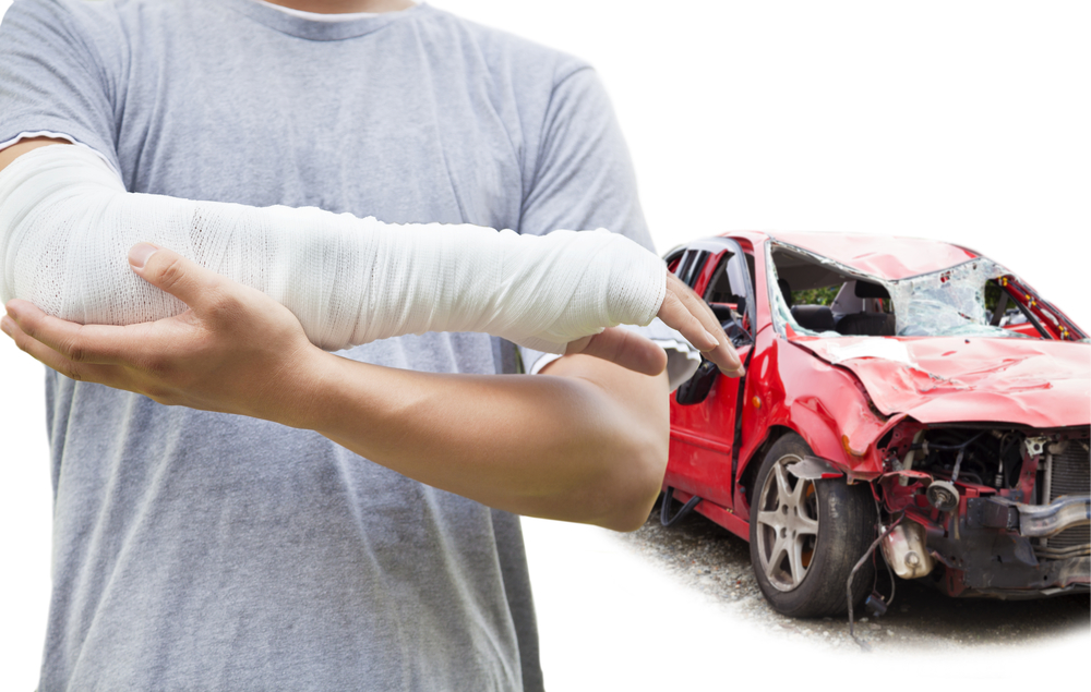 What To Do After Getting Injured In A Car Accident