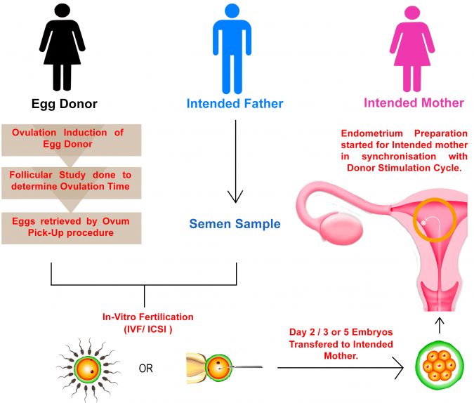 donor-egg-IVF-2-675x574 Facing Infertility Feelings: Choosing Frozen Donor Egg IVF