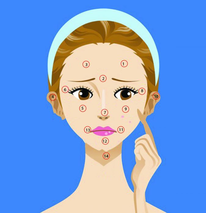 acne face map 9 Face Mapping Acne Spots and What Every Acne Spot Means? - 1