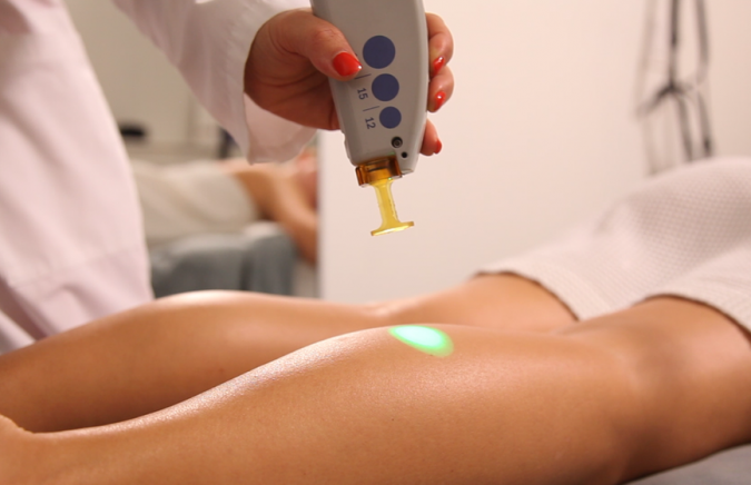 laser hair removal 6 Top 10 Shocking Facts about Laser Hair Removal - 9