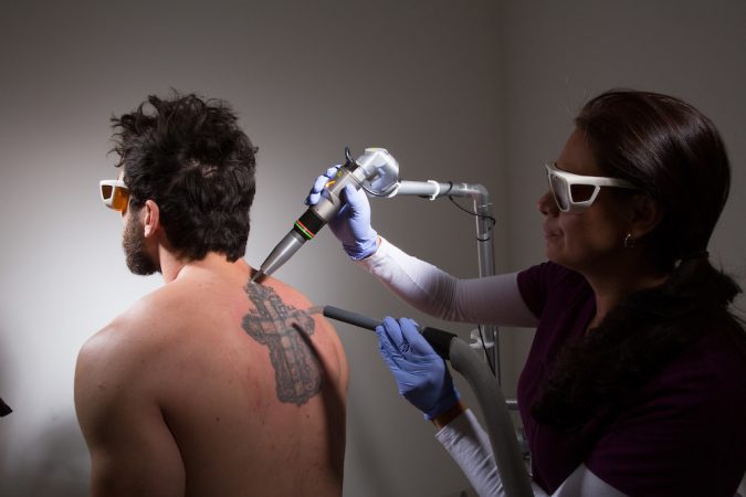 tattoo removal with laser 8 Easiest Remedies to Remove Skin Tattoo - 1