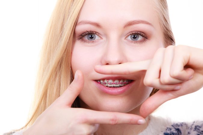 orthodontic-675x450 Debunking 7 Common Myths about Orthodontics
