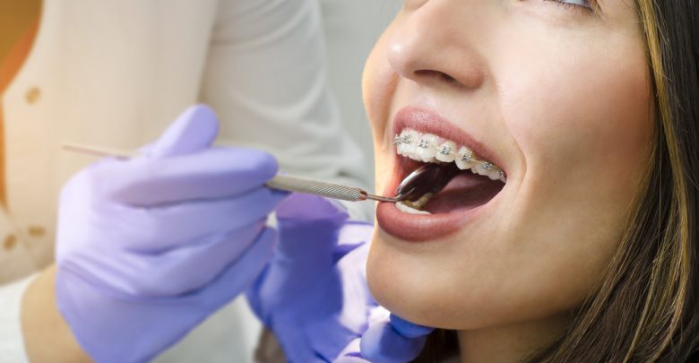 orthodontic care orthodontist Debunking 7 Common Myths about Orthodontics - Orthodontic care 1