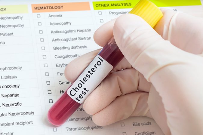 Best 10 Hemp Oil Uses and Benefits 15 cholesterol test Best 10 Hemp Oil Uses and Benefits - 15