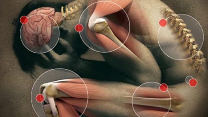 5 Reasons CBD Could Be Right for You 7 chronic pain 5 Reasons CBD Could Be Right for You - 7