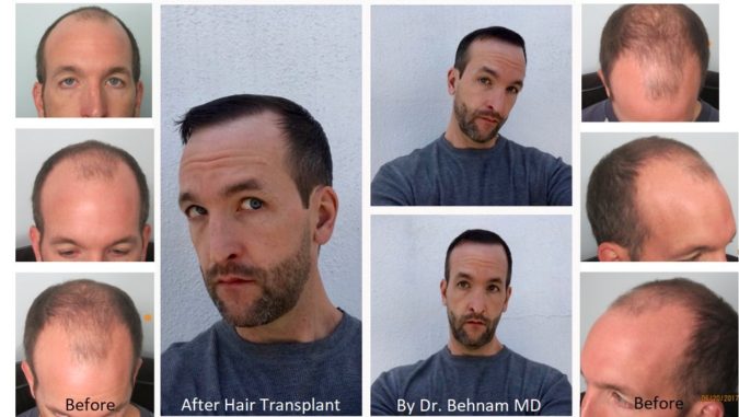 Dermatology Hair Restoration Specialists. Top 10 Hair Transplant Clinics in the USA - 8