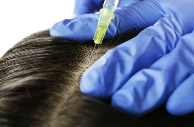 Top 10 Hair Transplant Clinics in the UK 20 FUE Clinics Hair Transplant Newcastle Top 10 Hair Transplant Clinics in the UK - 20