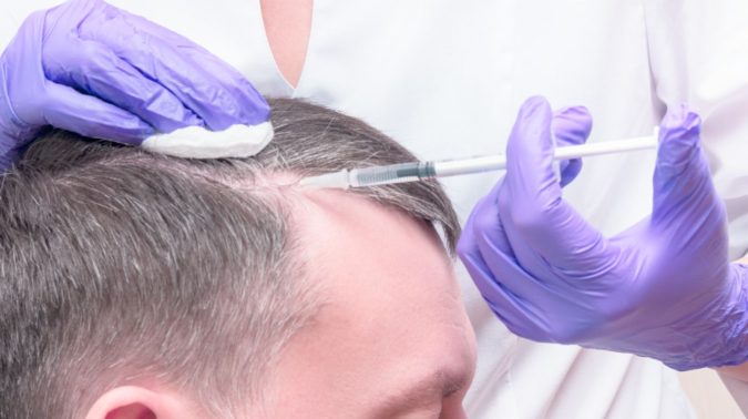Hair Restoration. Top 10 Hair Transplant Clinics in the USA - 20