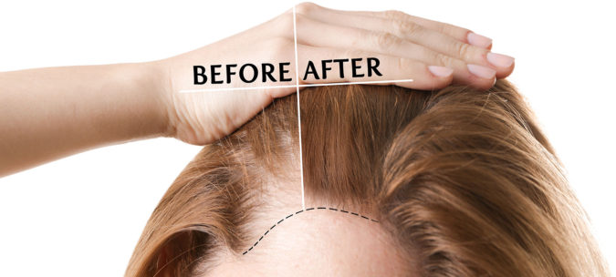 Top 10 Hair Transplant Clinics in the UK 11 London Hair Transplant Clinic Top 10 Hair Transplant Clinics in the UK - 11