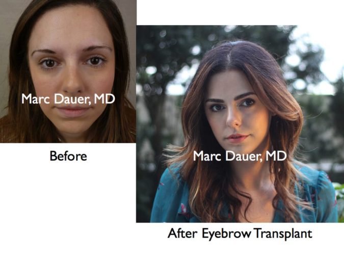 Marc Dauer MD. Top 10 Hair Transplant Clinics in the USA - 12