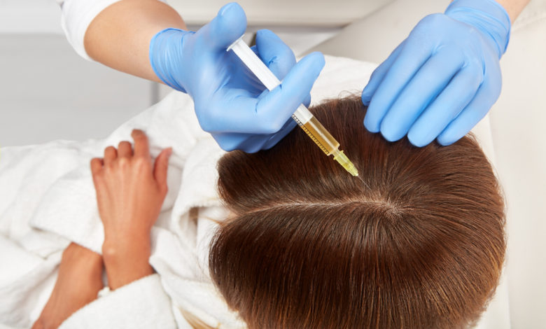 hair restoration Top 10 Hair Transplant Clinics in the USA - hair transplant treatment 1