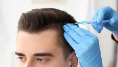 hair transplant Best 10 Hair Transplant Clinics in Dubai - Medical 8
