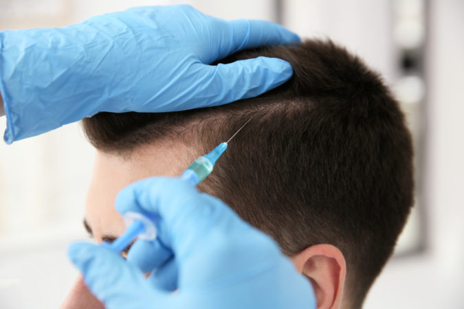 Top 10 Best Hair Transplant Clinics in Turkey 29 hair transplant surgery. Top 10 Best Hair Transplant Clinics in Turkey - 29