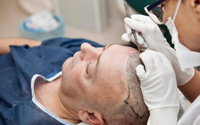 technology for hair surgery Top 10 Best Hair Transplant Clinics in Turkey - 26