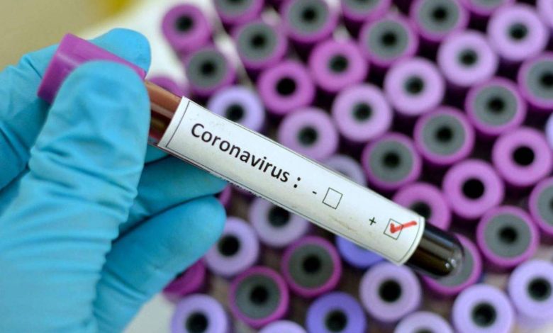 wuhan china coronavirus. Coronavirus Causes, Symptoms, and Possible Treatments - Coronavirus 16