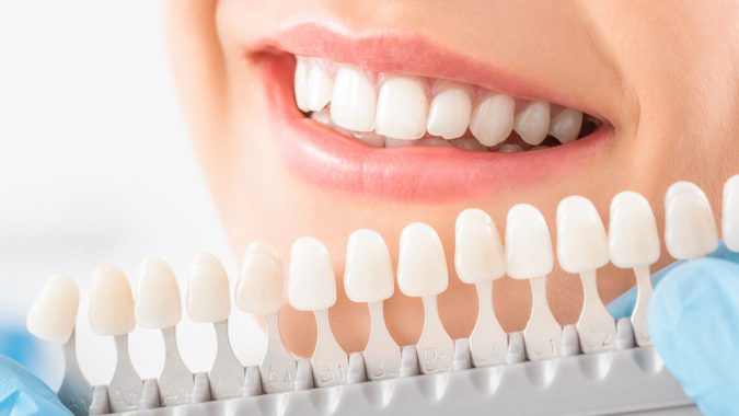3 Types of Cosmetic Dental Procedures That Will Work Wonders for Your Smile 2 teeth whitening 3 Types of Cosmetic Dental Procedures That Will Work Wonders for Your Smile - 2