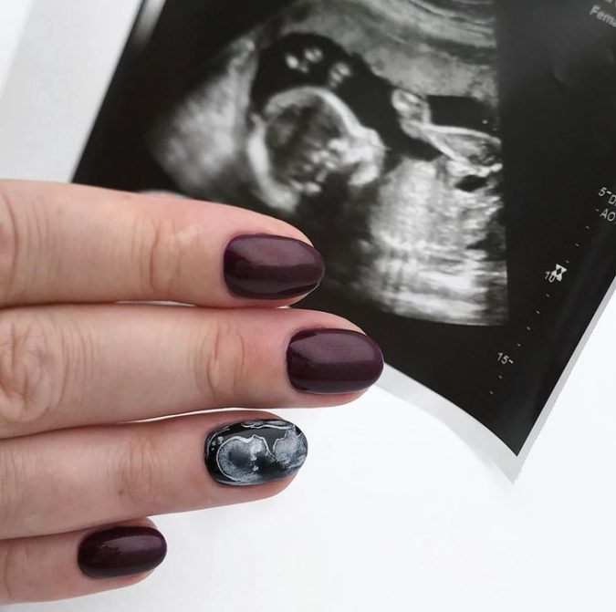 Sonogram Nails. 20 Weirdest Nail Art Ideas That Should Not Exist - 7