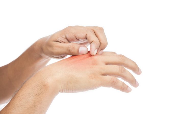 hand allergies Top 10 CBD Hand Sanitizer Benefits - 9