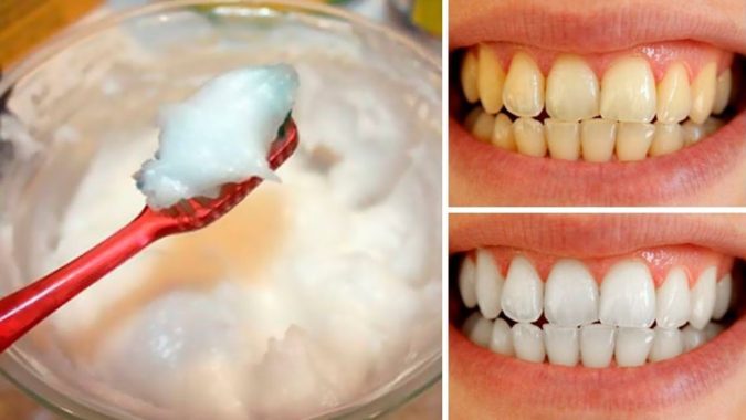 White teeth How to Get Natural "No-Makeup" Makeup Look for Work (Step by Step) - 9