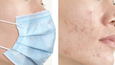 Mask Acne Protect Your Skin from Acne Caused by Face Mask with Simple Remedies - 118