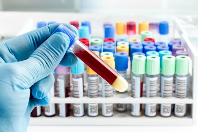Are Allergies Passed from Parent to Child? 10 allergy Blood testing Are Allergies Passed from Parent to Child? - 10