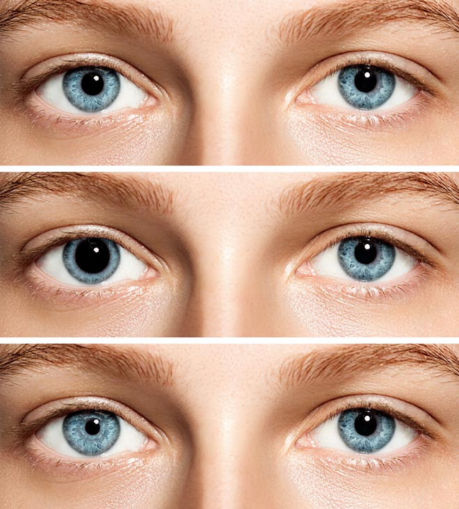 Anisocoria. 7 Rarest and Unusual Eye Colors That Looks Unreal
