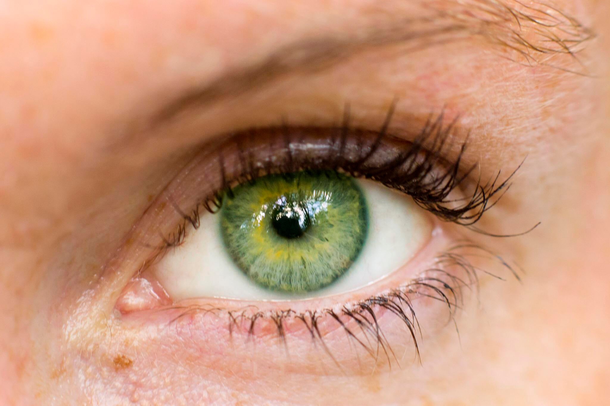 Green eye color 1 7 Rarest and Unusual Eye Colors That Looks Unreal - 11