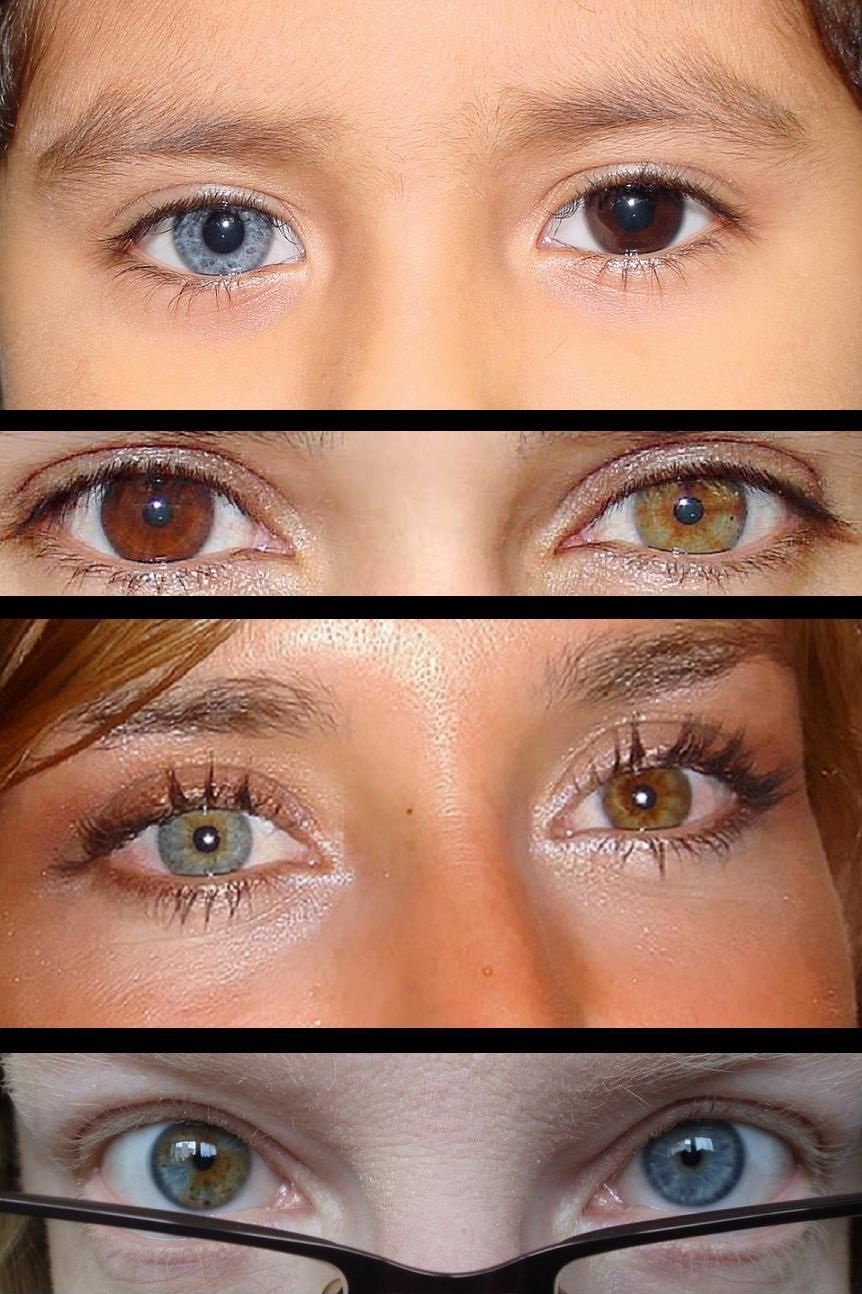 Heterochromia. 7 Rarest and Unusual Eye Colors That Looks Unreal - 2