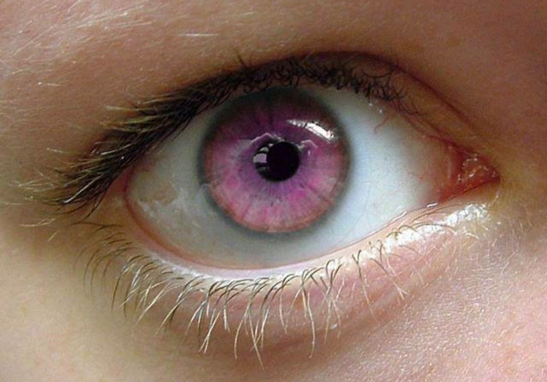 Почему глаза розовые. Розовые глаза. Фиолетово-красный цвет глаз. Бордовые глаза радужка.