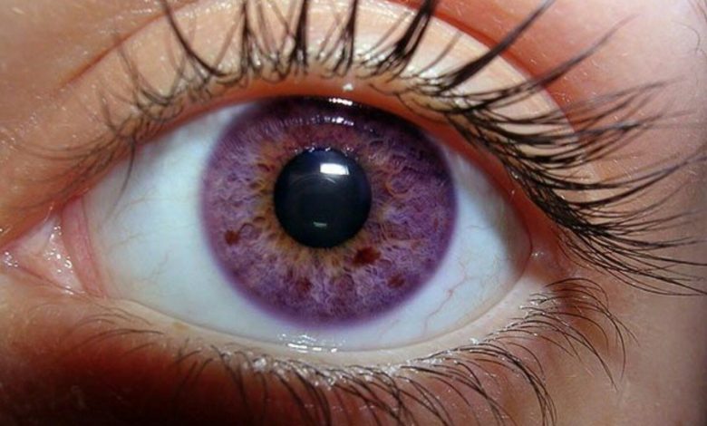 violet eye color 7 Rarest and Unusual Eye Colors That Looks Unreal - Rare eye colors 1