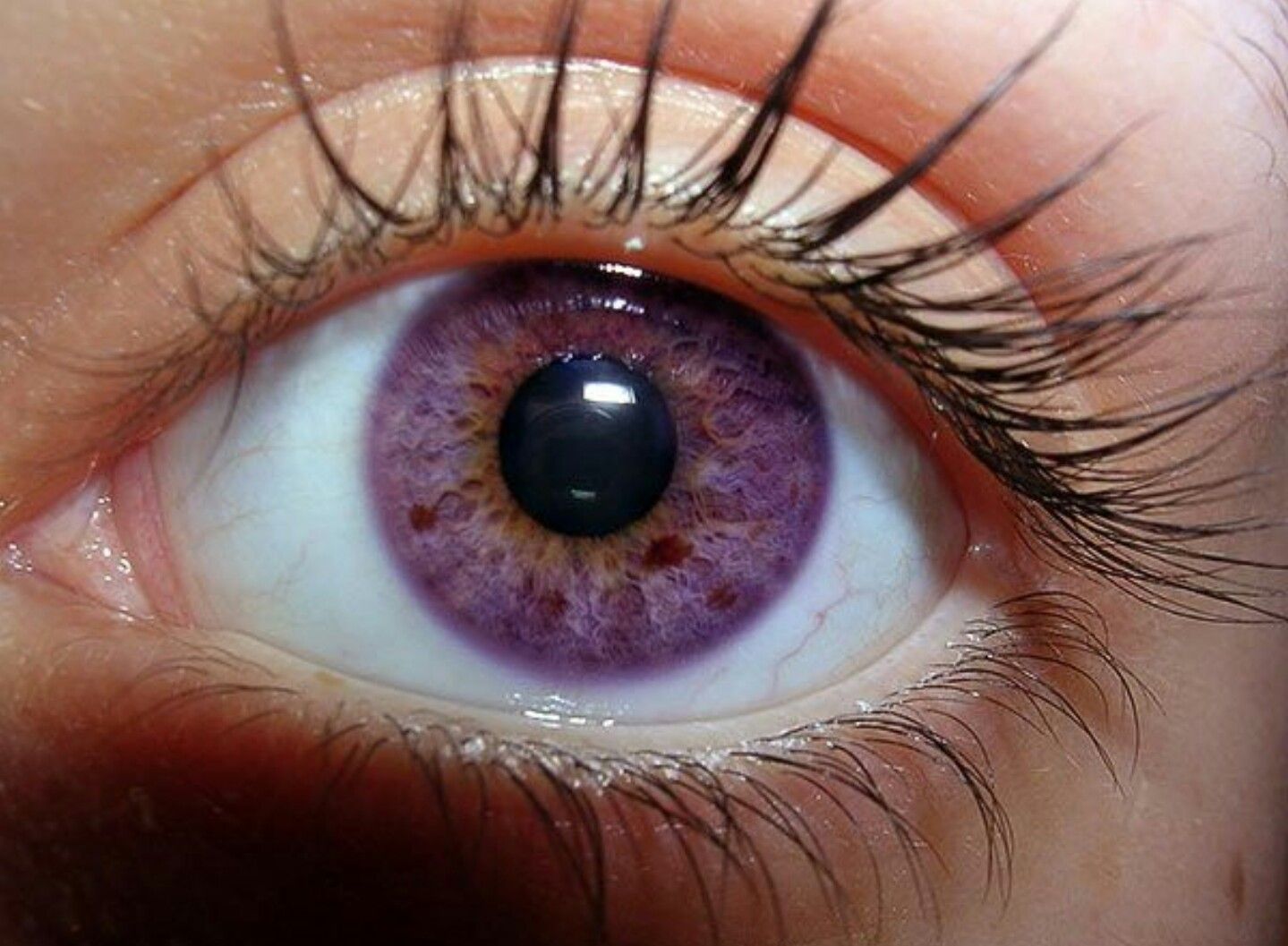 violet-eye-color 7 Rarest and Unusual Eye Colors That Looks Unreal