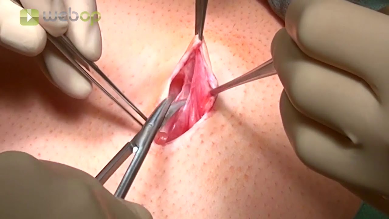 Webop Top 7 Benefits of Surgery Training Videos for Medical Institutes - 7