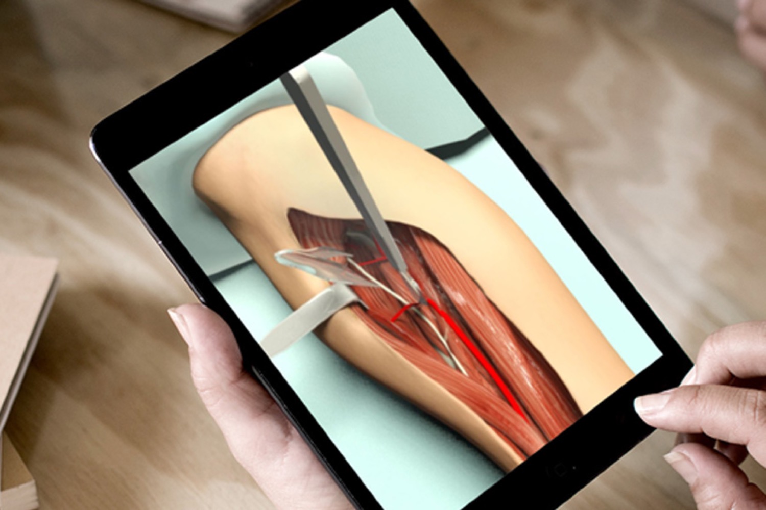 surgical video 1 Top 7 Benefits of Surgery Training Videos for Medical Institutes - 3