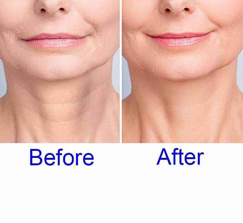 2021-11-10_230735 Top 10 Skincare tricks for women over 50 to look much younger - From Beauty Experts