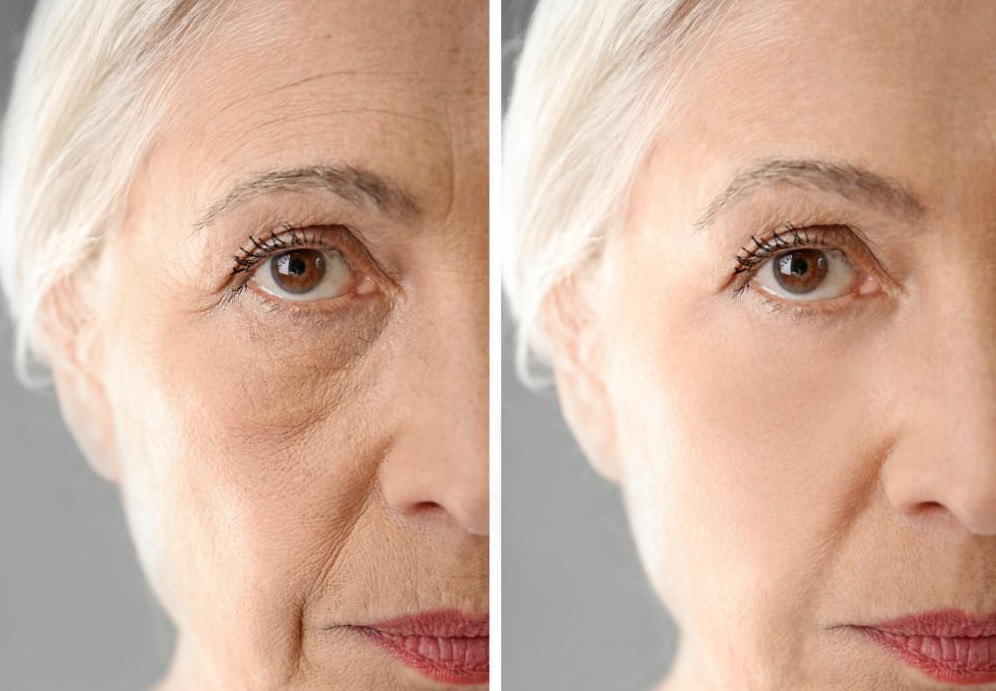 2021-11-11_125031 Top 10 Natural "No Makeup" Hacks to Look younger in your 50s