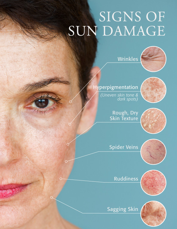 sunscreen reverses aging signs