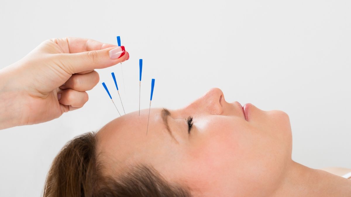 Acupuncture Cosmetic Procedures to Combat Common Aging